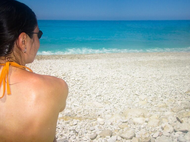 On vous donne une recette pour faire un après-soleil bio à la maison, pour éviter les coups de soleil